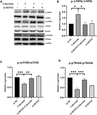 Calycosin induces autophagy and apoptosis via Sestrin2/AMPK/mTOR in human papillary thyroid cancer cells